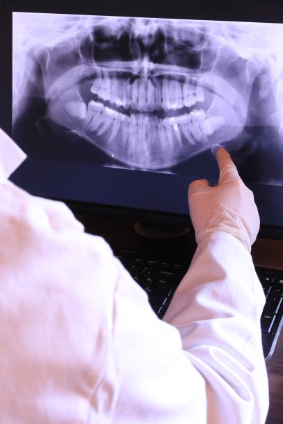 Best Emergency Root Canal Treatment in Roma, TX